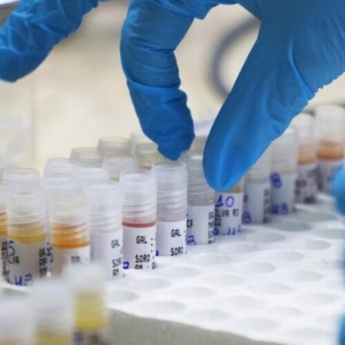 Total de casos de Mpox no Brasil chega a 140 em 2026