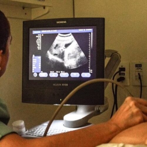 Unidade Móvel de Saúde do Amazonas realiza exames de imagem no bairro Japiim até o final desta semana
