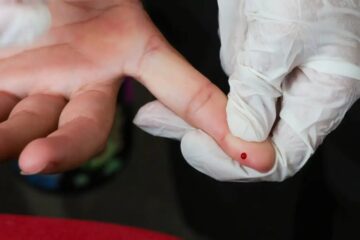 SUS amplia acesso a teste rápido para detecção da dengue