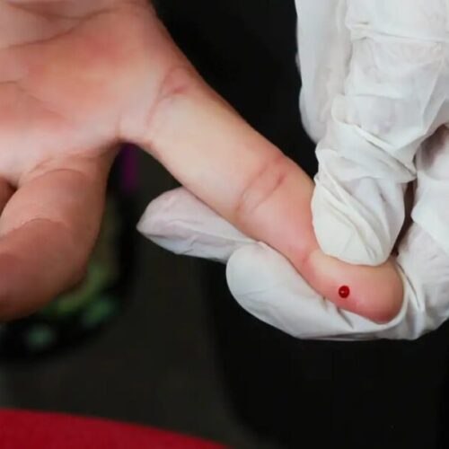 SUS amplia acesso a teste rápido para detecção da dengue